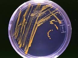 Reasons Behind Culture Media Agar Failing to Solidify and Effective Solutions