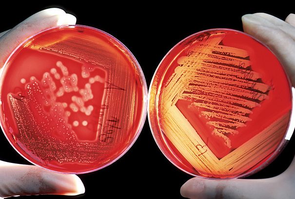 How to Pour Culture Media: Steps and Best Practices