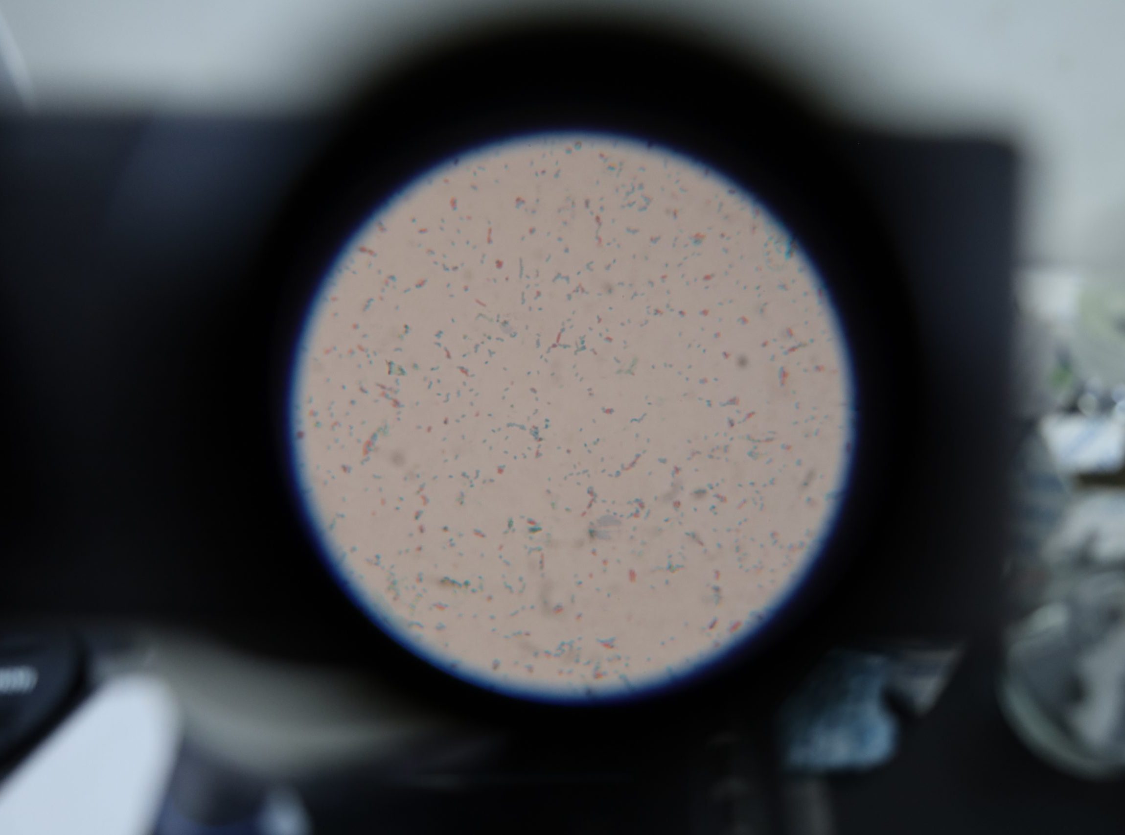 Mastering the Art of Spore Staining: A Crucial Microbiology Skill