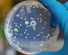 Purification Methods for Contaminated Microbial Strains